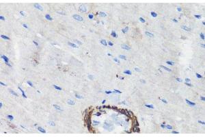 Immunohistochemistry of paraffin-embedded Rat heart using FLNA Polyclonal Antibody at dilution of 1:100 (40x lens). (Filamin A 抗体)
