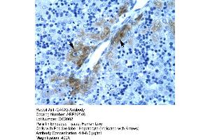 Rabbit Anti-GATA3 Antibody  Paraffin Embedded Tissue: Human Liver Cellular Data: Hepatocyte Antibody Concentration: 4. (GATA3 抗体  (C-Term))
