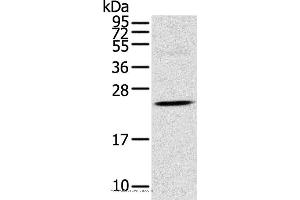 Western blot analysis of Human fetal brain tissue, using TSPAN13 Polyclonal Antibody at dilution of 1:550 (TSPAN13 抗体)