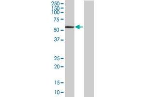 Western Blot analysis of ALDH6A1 expression in transfected 293T cell line by ALDH6A1 MaxPab polyclonal antibody. (ALDH6A1 抗体  (AA 1-535))