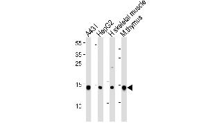 Western blot analysis of lysates from A431, HepG2 cell line, human skeletal muscle and mouse thymus tissue lysate(from left to right), using hUBE2D1- B. (UBE2D1 抗体  (C-Term))