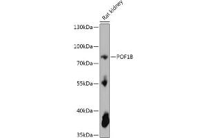 Western blot analysis of extracts of Rat kidney, using POF1B antibody (ABIN7269509) at 1:1000 dilution. (POF1B 抗体  (AA 330-560))