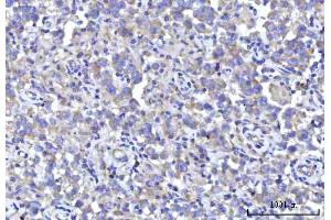 IHC analysis of RPS5 using anti-RPS5 antibody (ABIN7599076).