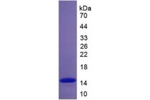SDS-PAGE of Protein Standard from the Kit  (Highly purified E. (Complement Factor B ELISA 试剂盒)