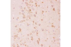 Anti-Tuberin Picoband antibody,  IHC(P): Rat Brain Tissue (Tuberin 抗体  (AA 1611-1807))
