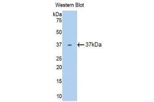 Western Blotting (WB) image for anti-Fms-Related tyrosine Kinase 1 (VEGFR1) (FLT1) (AA 27-329) antibody (ABIN3206010) (FLT1 抗体  (AA 27-329))