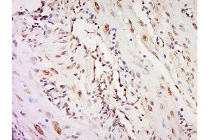 Paraformaldehyde-fixed, paraffin embedded mouse placenta, Antigen retrieval by boiling in sodium citrate buffer (pH6) for 15min, Block endogenous peroxidase by 3% hydrogen peroxide for 30 minutes, Blocking buffer (normal goat serum) at 37°C for 20min, Antibody incubation with 	NOR1 Polyclonal Antibody, Unconjugated  at 1:500 overnight at 4°C, followed by a conjugated secondary and DAB staining. (NR4A3 抗体  (AA 521-626))
