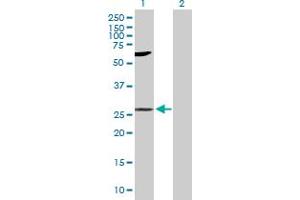 Western Blot analysis of LIN7A expression in transfected 293T cell line by LIN7A MaxPab polyclonal antibody. (LIN7A 抗体  (AA 1-233))