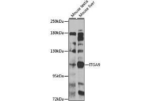 Western blot analysis of extracts of various cell lines, using ITG antibody (ABIN6133048, ABIN6142571, ABIN6142573 and ABIN6223622) at 1:1000 dilution. (ITGA9 抗体  (AA 30-250))