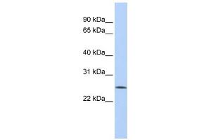 FBXO22 antibody used at 1 ug/ml to detect target protein. (FBXO22 抗体  (Middle Region))