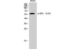 Western Blotting (WB) image for anti-Estrogen Receptor 2 (ESR2) (pSer105) antibody (ABIN3173178) (ESR2 抗体  (pSer105))