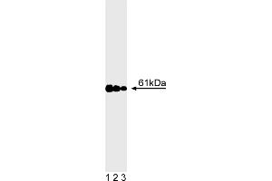 Western Blotting (WB) image for anti-Calcineurin (CAN) (AA 349-505) antibody (ABIN967510) (CAN 抗体  (AA 349-505))