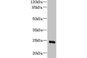 Western blot All lanes: MED18 antibody at 0. (MED18 抗体  (AA 35-208))