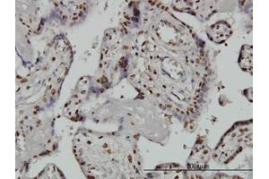 Image no. 3 for anti-AT Rich Interactive Domain 1B (SWI1-Like) (ARID1B) (AA 1364-1461) antibody (ABIN599288) (ARID1B 抗体  (AA 1364-1461))