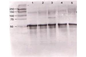 Rabbit anti-Ang-1 was used at a 1:500 dilution to detect mouse Ang-1 by western blot against supernatants of mouse angiopoietin-expressing endothelial cells. (Angiopoietin 1 抗体  (N-Term))