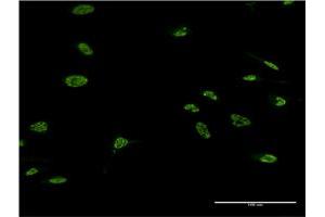 Immunofluorescence of monoclonal antibody to LHX4 on HeLa cell. (LHX4 抗体  (AA 291-390))