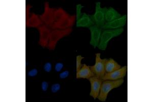 SOD1 Mouse Monoclonal Antibody staining Hela cells by IF/ICC. (SOD1 抗体  (Internal Region))