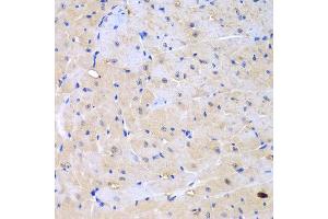Immunohistochemistry of paraffin-embedded mouse heart using ARHGEF9 antibody at dilution of 1:100 (40x lens).