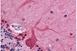 Immunohistochemistry (Formalin-fixed Paraffin-embedded Sections) (IHC (fp)) image for anti-Coronin, Actin Binding Protein, 1B (CORO1B) (AA 1-490) antibody (ABIN574458)