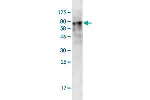 Western Blot detection against Immunogen (73. (LACC1 抗体  (AA 1-430))