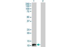 Western Blotting (WB) image for anti-Cleavage Stimulation Factor, 3' Pre-RNA, Subunit 3, 77kDa (CSTF3) (AA 1-104) antibody (ABIN598634) (CSTF3 抗体  (AA 1-104))