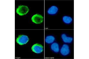 Immunofluorescence staining of fixed Jurkat cells with anti-CD154 antibody IDEC-131 (Toralizumab). (Recombinant sCD40L (Toralizumab Biosimilar) 抗体)