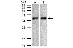 WB Image Sample(30 μg of whole cell lysate) A:A431, B:HeLa S3, 12% SDS PAGE antibody diluted at 1:500 (ZPBP 抗体)
