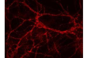 Indirect immunostaining of PFA fixed rat hippocampus neurons (dilution 1 : 500). (SLC6A1 抗体)