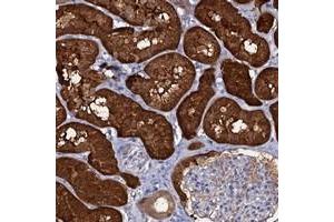 Immunohistochemical staining of human kidney with CRYL1 polyclonal antibody  shows strong cytoplasmic positivity in cells in tubules along with distinct extracellular material.