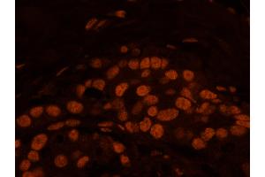 Immunofluorescence (IF) image for anti-Matrin 3 (MATR3) (C-Term) antibody (ABIN7448986)