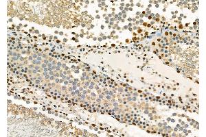 ABIN6261827 and ABIN6278382 at 1/100 staining Rat testis tissue by IHC-P. (FTO 抗体  (C-Term))