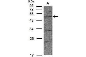 WB Image Sample(30 μg of whole cell lysate) A:A431, 10% SDS PAGE antibody diluted at 1:1500 (FBXW2 抗体  (C-Term))