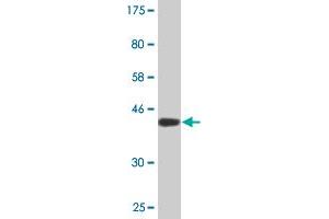 Western Blot detection against Immunogen (40. (BRD3 抗体  (AA 418-556))
