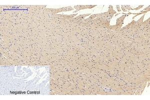 Immunohistochemical analysis of paraffin-embedded rat heart tissue. (PIK3R1 抗体  (pTyr607))