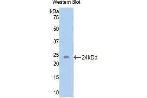 Western blot analysis of the recombinant protein. (Activin A Receptor Type IB/ALK-4 抗体  (AA 207-385))