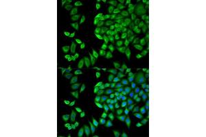 Immunofluorescence analysis of HeLa cells using WNK1 antibody. (WNK1 抗体  (AA 1-210))