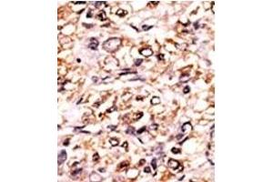 Image no. 1 for anti-Extra Spindle Poles Like 1 (ESPL1) (pSer1126) antibody (ABIN358223) (Separase 抗体  (pSer1126))