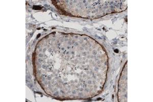 Immunohistochemical staining (Formalin-fixed paraffin-embedded sections) of human testis with LAMA1 monoclonal antibody, clone CL2968  shows strong immunoreactivity in basement membrane of seminiferous tubules. (Laminin alpha 1 抗体)