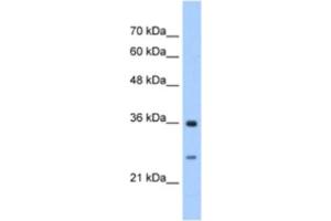 Western Blotting (WB) image for anti-Glutathione Transferase zeta 1 (Maleylacetoacetate Isomerase) (GSTZ1) antibody (ABIN2463253) (GSTZ1 抗体)