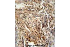 Immunohistochemistry (IHC) image for anti-Colony Stimulating Factor 2 (Granulocyte-Macrophage) (CSF2) antibody (ABIN2995782) (GM-CSF 抗体)