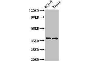 Western Blot Positive WB detected in: MCF-7 whole cell lysate, Rat brain tissue All lanes: MENT antibody at 3. (MENT (AA 24-197) 抗体)