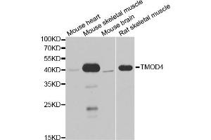 Western blot analysis of extracts of various cell lines, using TMOD4 antibody (ABIN5974100) at 1/1000 dilution. (Tropomodulin 4 抗体)