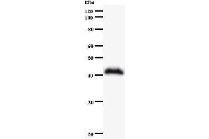 Western Blotting (WB) image for anti-SWI/SNF Related, Matrix Associated, Actin Dependent Regulator of Chromatin, Subfamily A, Member 4 (SMARCA4) antibody (ABIN930944) (SMARCA4 抗体)