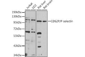 Western blot analysis of extracts of various cell lines, using CD62P/P-selectin antibody (ABIN6131514, ABIN6147503, ABIN6147506 and ABIN6218519) at 1:1000 dilution. (P-Selectin 抗体  (AA 30-200))
