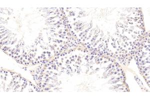 Detection of AXL in Rat Testis Tissue using Polyclonal Antibody to AXL Receptor Tyrosine Kinase (AXL) (AXL 抗体  (AA 21-202))
