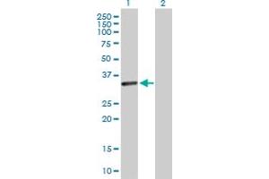 Western Blot analysis of CENPP expression in transfected 293T cell line by CENPP MaxPab polyclonal antibody. (CENPP 抗体  (AA 1-288))
