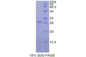 SDS-PAGE (SDS) image for Glutathione S-Transferase pi 1 (GSTP1) (AA 1-210) protein (His tag) (ABIN1079720) (GSTP1 Protein (AA 1-210) (His tag))