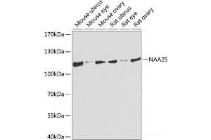 Western blot analysis of extracts of various cell lines using NAA25 Polyclonal Antibody at dilution of 1:1000. (NAA25 抗体)