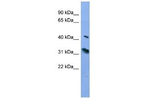 WB Suggested Anti-RHO Antibody Titration: 0. (Rho-related GTP-binding protein 抗体  (C-Term))