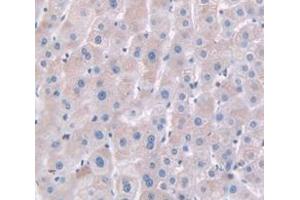 IHC-P analysis of Human Tissue, with DAB staining. (HPR 抗体  (AA 102-347))